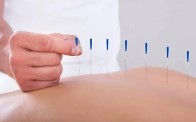 HOW SPORTS ACUPUNCTURE TREATS MUSCLE PAIN AND TIGHTNES